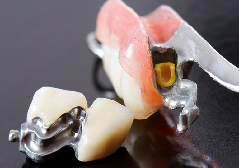 Tarifs Adjointes Dental Plus